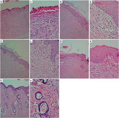 Corrigendum: In vitro and in vivo evaluation of alginate hydrogel-based wound dressing loaded with green chemistry cerium oxide nanoparticles